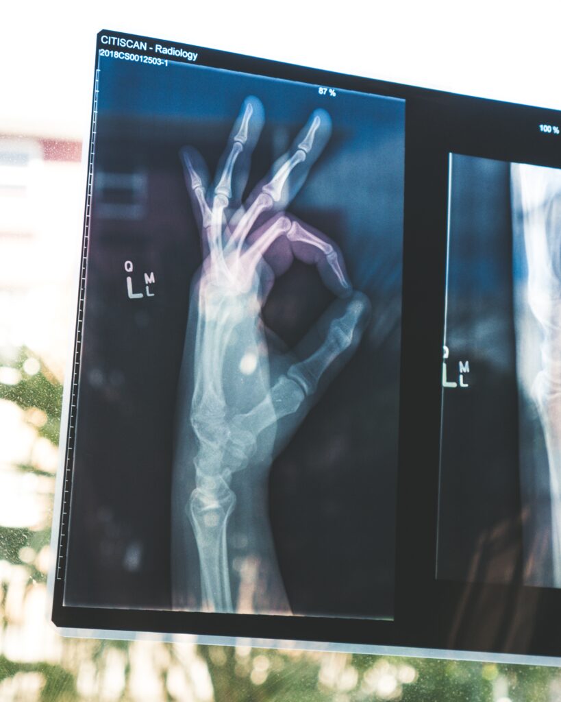 Understanding the Timeframe of Hearing Loss Understanding the Timeframe of Hearing Loss