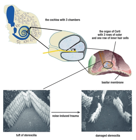 The Impact of Hearing Loss on Quality of Life