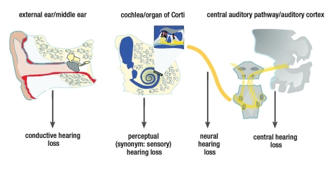 The Impact of Hearing Loss on Quality of Life