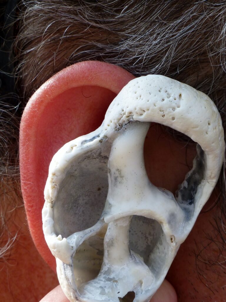 Protective Effects of Vitamins and Antioxidants on Occupational Noise-Induced Hearing Loss: A Systematic Review Protective Effects of Vitamins and Antioxidants on Occupational Noise-Induced Hearing Loss: A Systematic Review