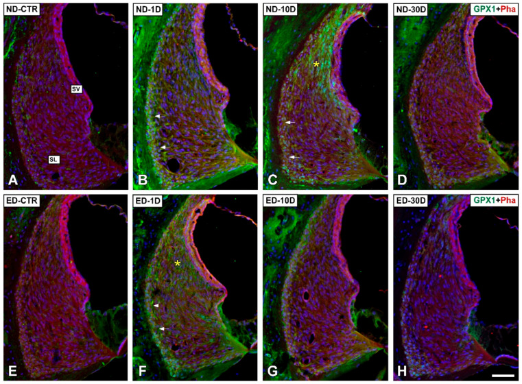 The Effects of Oral ACEMg on Noise-Induced Hearing Loss in Rats