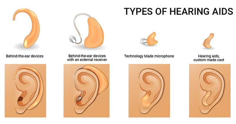 The Link Between Nutrients and Hearing Health: A Comprehensive Review