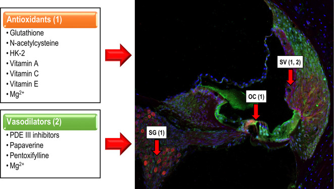 The Role of Antioxidants in Treating Noise-Induced Hearing Loss The Role of Antioxidants in Treating Noise-Induced Hearing Loss